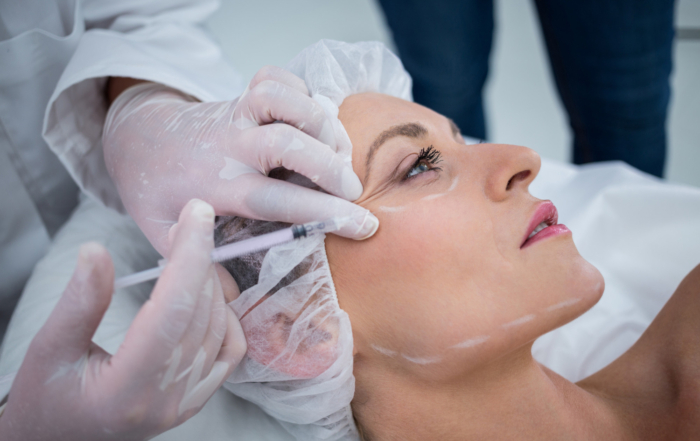 woman-with-marked-face-receiving-botox-injection